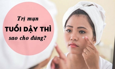 Cách trị mụn tuổi dậy thì nữ tại nhà an toàn và hiệu quả