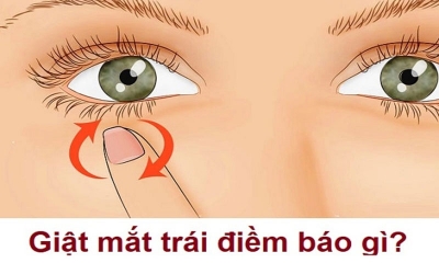 Mắt trái giật điềm báo gì ở nam, nữ? Liệu có phải là bệnh