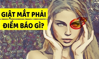 Giải đáp hiện tượng mắt phải giật ở nam, nữ là hên hay xui?